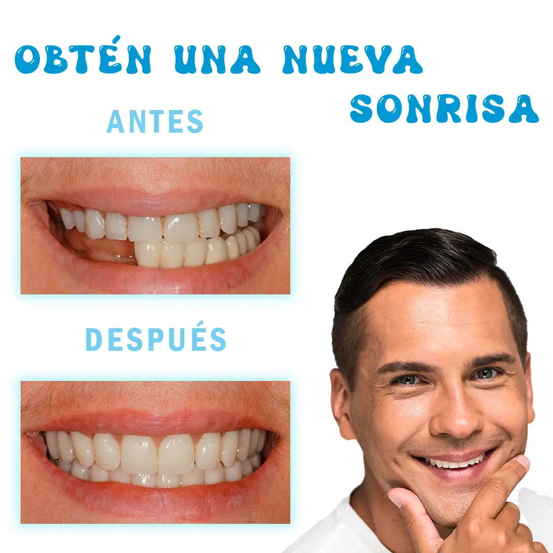 Resina Dental Moldeable: Logra Tu Sonrisa Perfecta 😍