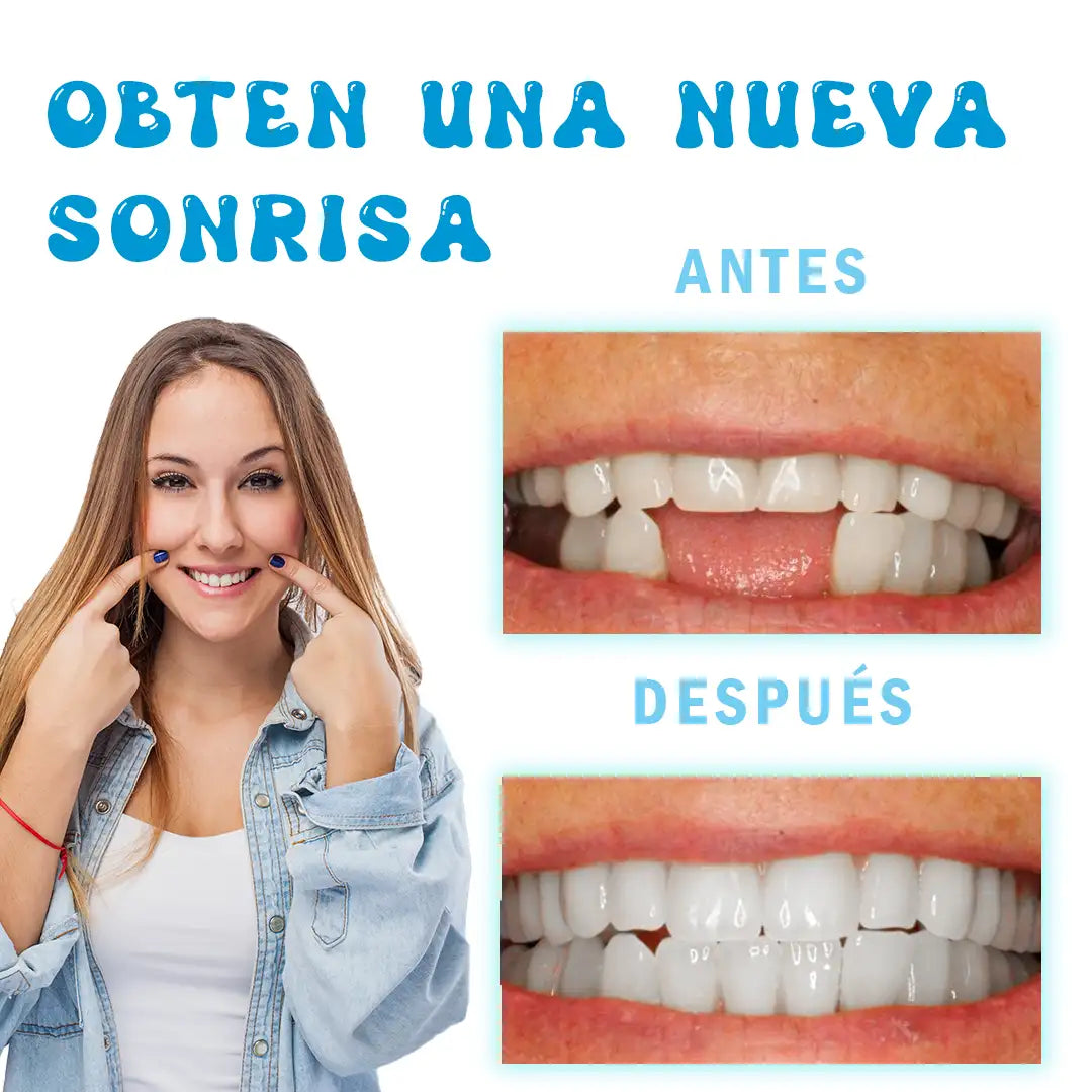Resina Dental Moldeable: Logra Tu Sonrisa Perfecta 😍