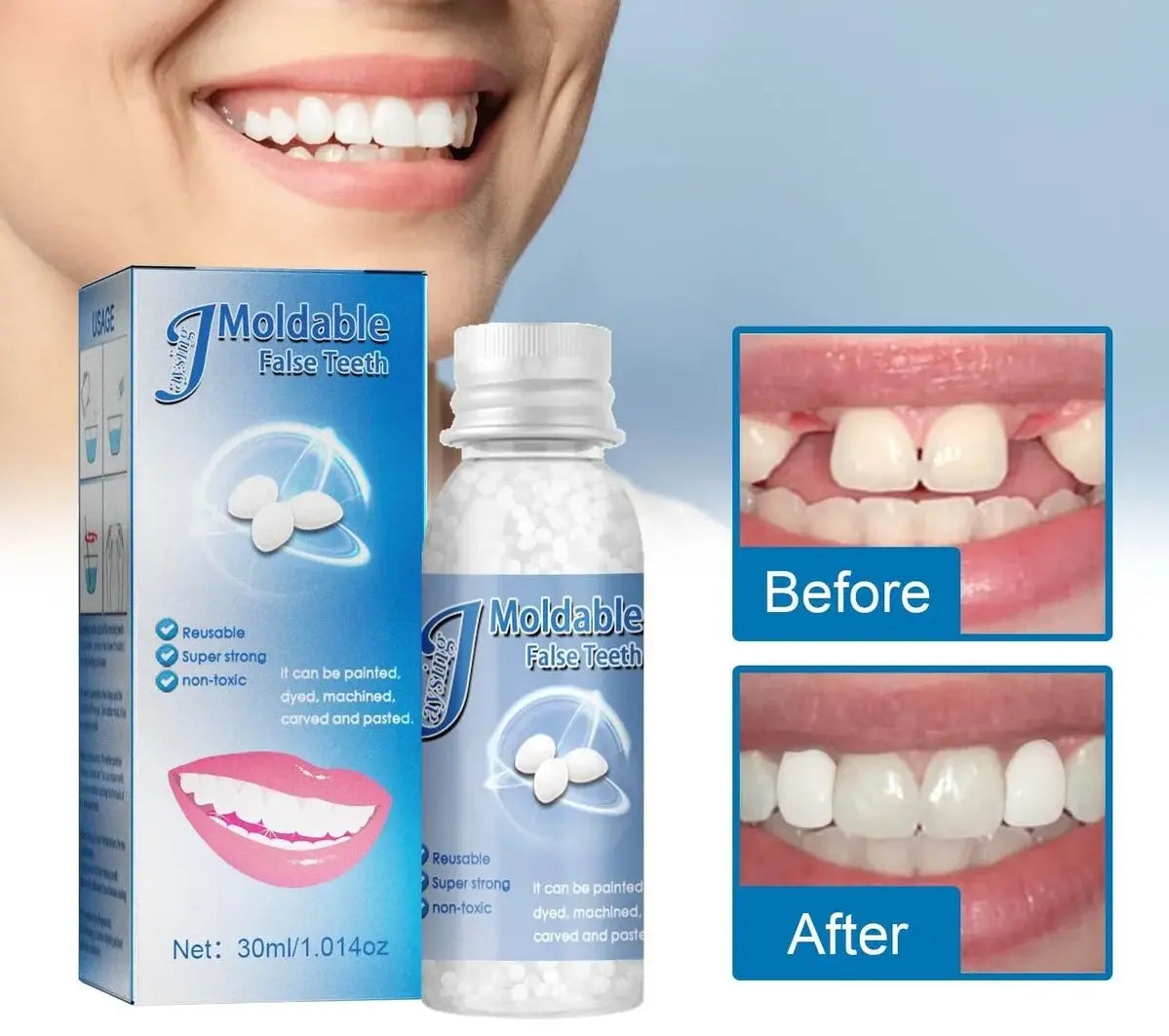 Resina Dental Moldeable: Logra Tu Sonrisa Perfecta 😍