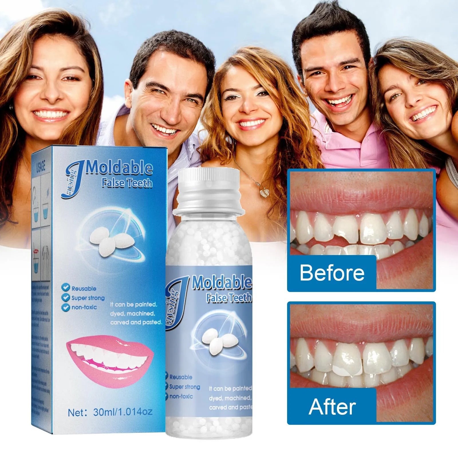 Resina Dental Moldeable: Logra Tu Sonrisa Perfecta 😍